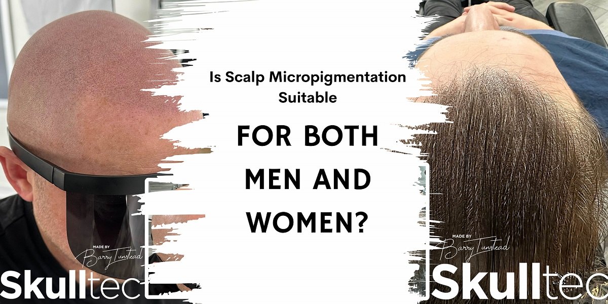 Scalp Micropigmentation For Men and Women